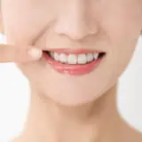 矯正 ほうれい線