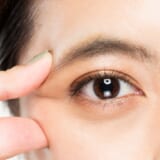 【まぶたがしわしわ】になる4つの原因。自力で目立たなくする方法はある?医師監修