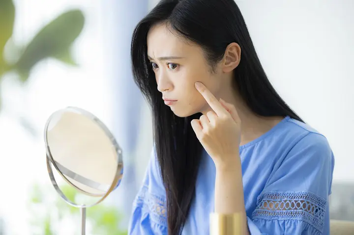 好転反応 ニキビ 顔つき