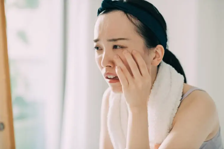 肌荒れ レチノール a反応